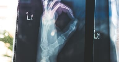 KardiaMobile 1-Lead Personal EKG Monitor